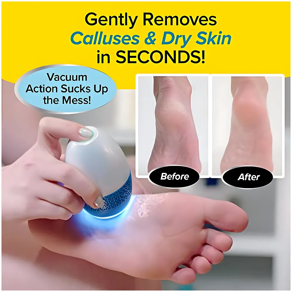 Electric Callus Remover Foot File Built in Vacuum 2 Speeds LED