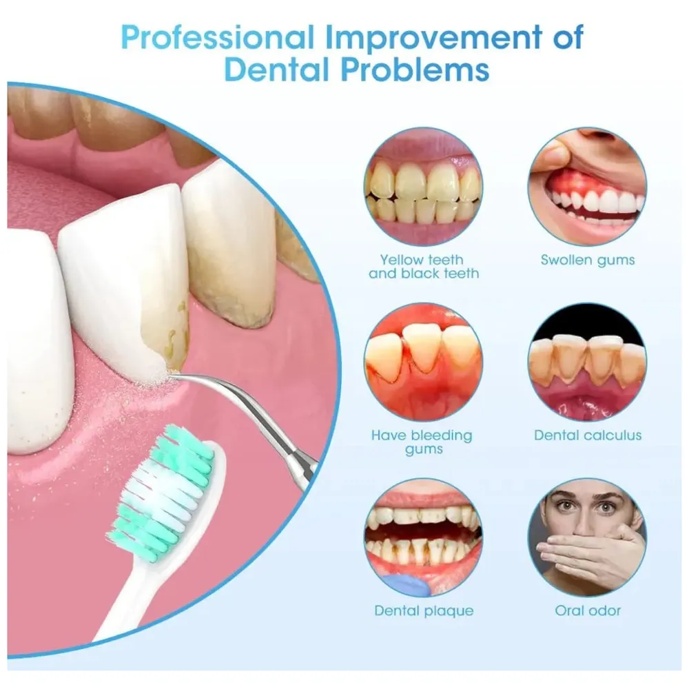 Calculus Remover Teeth Whitening Kit Tooth Cleaner Set Oral Care Electric Toothbrush Plaque Remover Tartar Removal Dental Scaler Stainless Steel Calculus Dental tools Professional