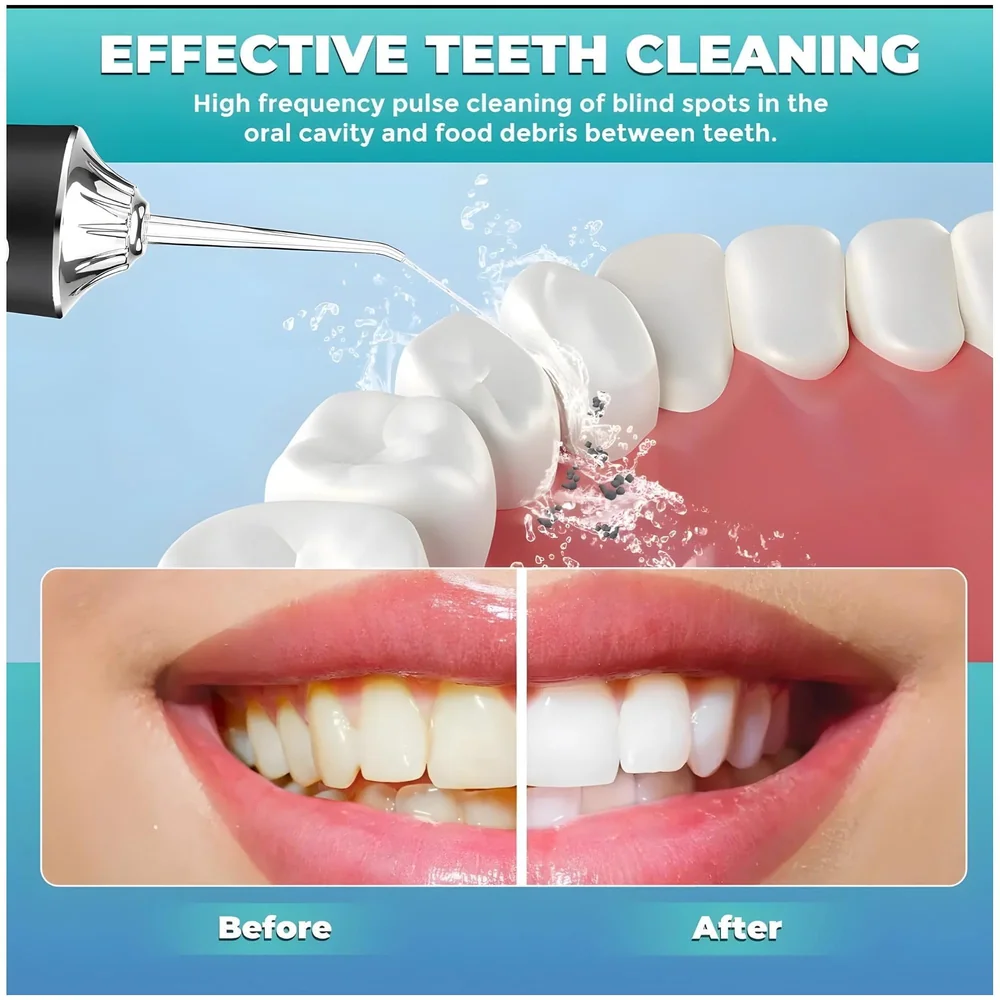 Black Water Flosser Portable Dental Water Jet Oral Teeth Irrigator Waterproof Tooth Cleaner Water Flosser Oral Flosser 3 Modes And 4 Nozzels 220 ML