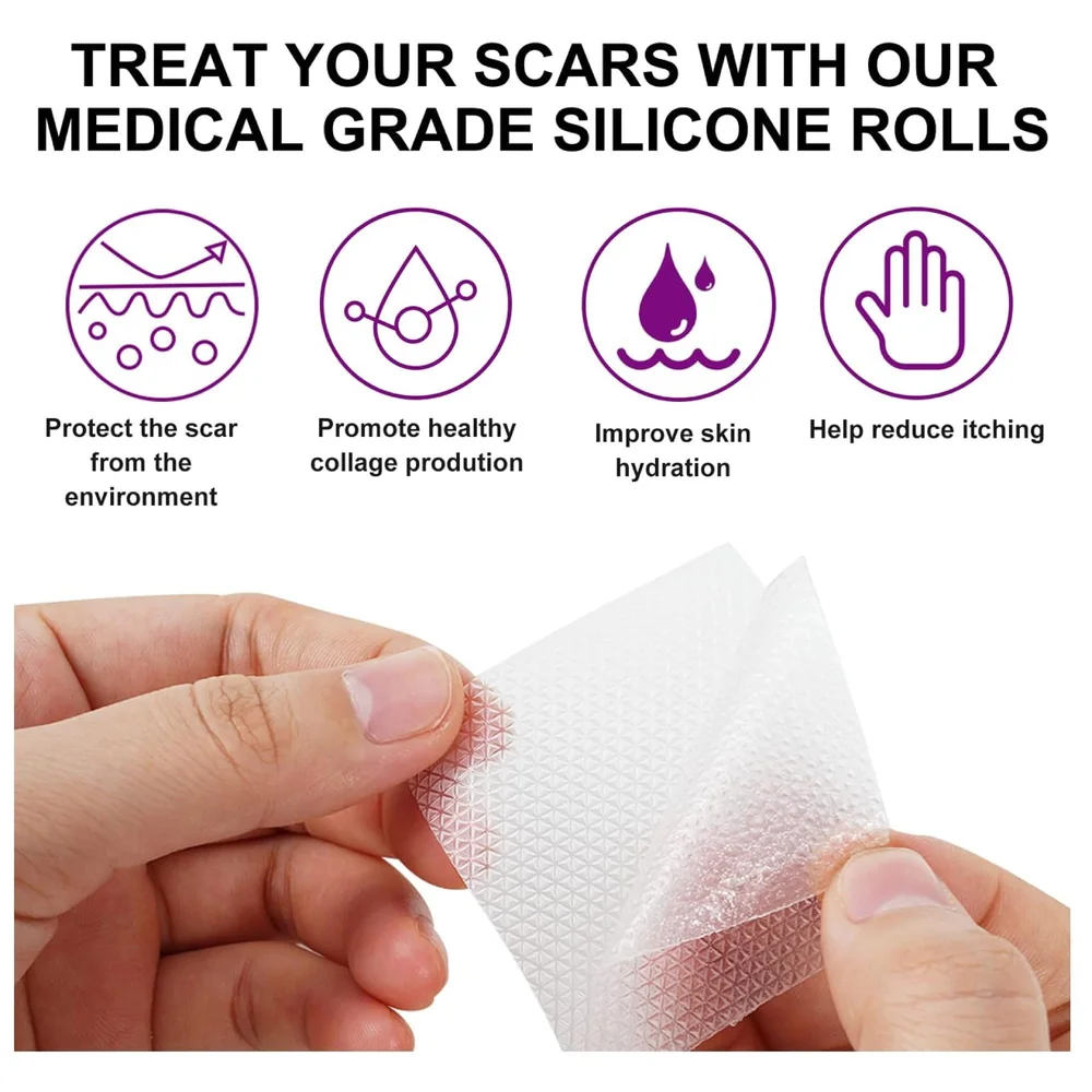 Clear Silicon Scar Sheet 4 x 150 Cm for Healing Scars Transparent tear silicone tape roll for hypertrophic scars and keloids caused by surgery, medical silicone for scar removal
