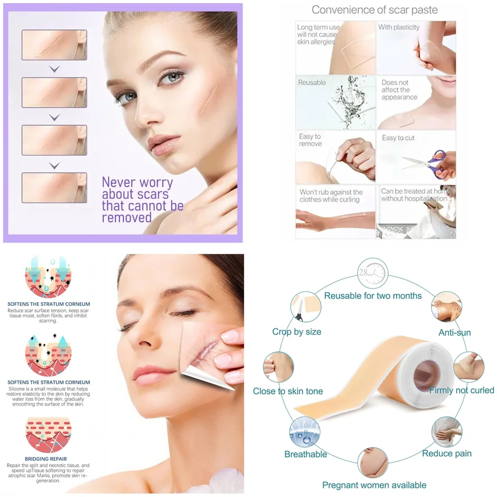 Clear Silicon Scar Sheet 4 x 150 Cm for Healing Scars Transparent tear silicone tape roll for hypertrophic scars and keloids caused by surgery, medical silicone for scar removal