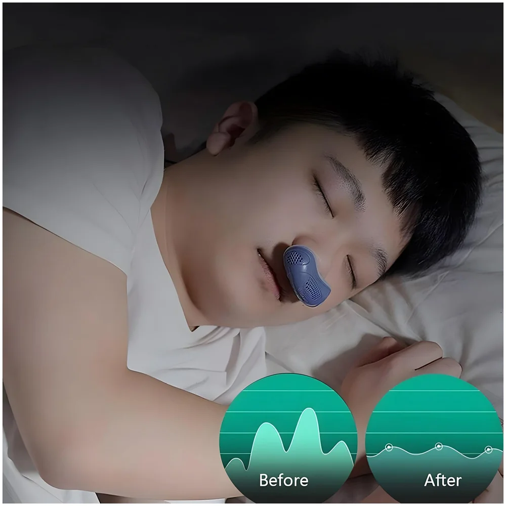Upgraded Electric Noise Anti Snoring Device Sleep Stop Snore Aid Stopper, Stop Snoring Aids Devices Solution Small Travel